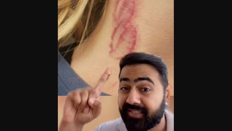 Hati-Hati Beri Cupang di Leher, Bisa Bikin Stroke