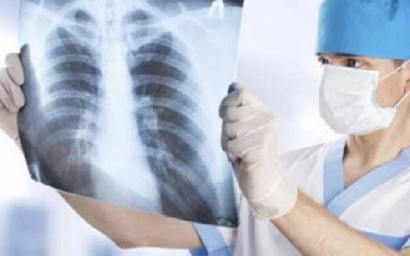 Cegah dan Obati Tuberkulosis Sampai Sembuh