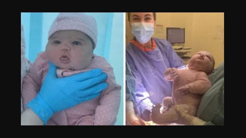 Wow, Bayi Ini Lahir Sehat dengan Berat Badan 6 Kg Panjang 58 Cm