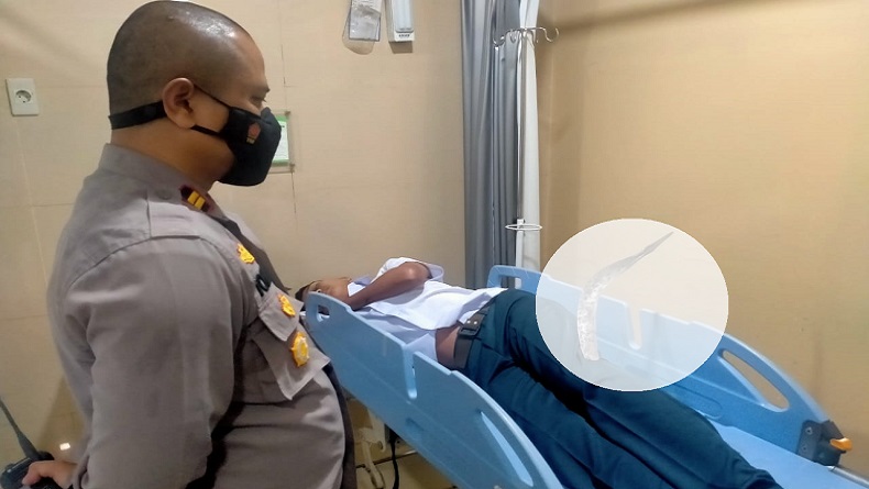 Hendak Pulang Sekolah, Pelajar di Kebonpedes Sukabumi Dibacok Sajam Jenis Corbek