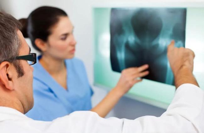 Cegah Osteoporosis, Konsumsi Kalsium dan Vitamin D Wajib sebelum Usia 30 Tahun