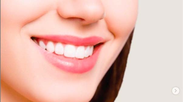 Cara Memutihkan Gigi Menggunakan Bahan Alami, Bisa dengan Mengonsumsi Apel dan Nanas
