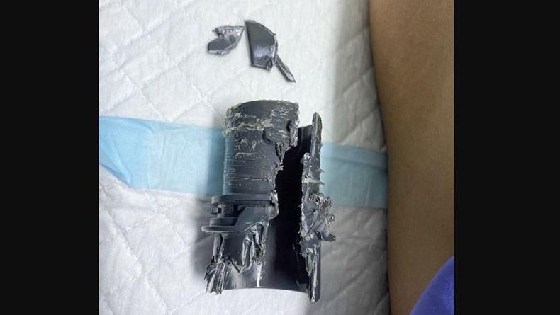 Duh, Alat Vital Pria Ini Nyangkut di Pipa Plastik