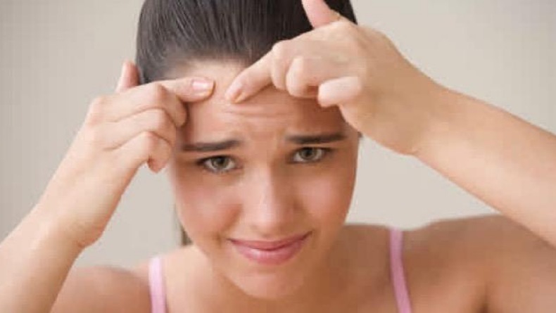 6 Cara Ini Ampuh Hilangkan Jerawat