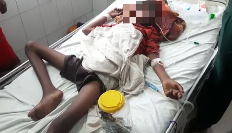 Bocah Ini Nekat Makan 16 Sikat Gigi dan Paku, Alasannya Bikin Geleng Kepala