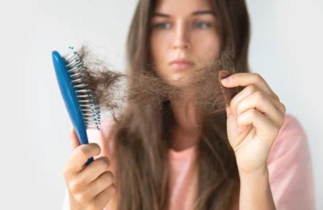 7 Cara Mengatasi Rambut Rontok, Salah Satunya Konsumsi Multivitamin