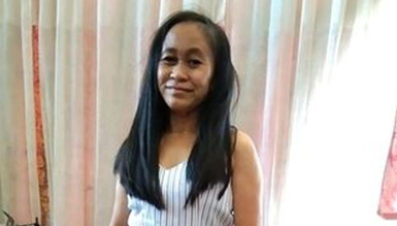 Penyakit Langka, Wajah Remaja 16 Tahun Ini seperti Perempuan Lanjut Usia