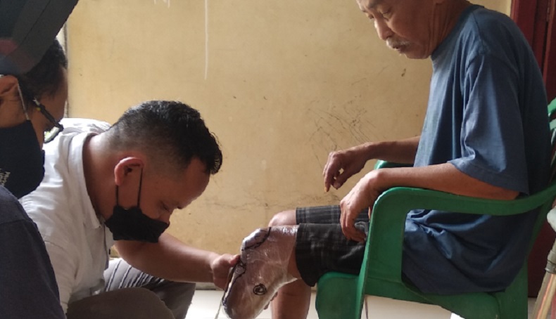 Kaki Diamputasi akibat Diabetes, Daryono Dapat Kaki Palsu dari MNC Peduli