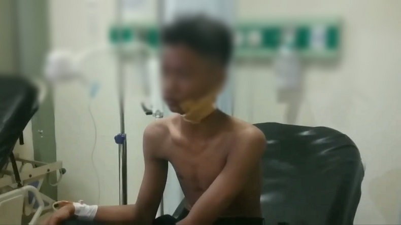 Ikut Ajakan Tawuran di Medsos, Siswa SMP di Duren Sawit Kena Bacok