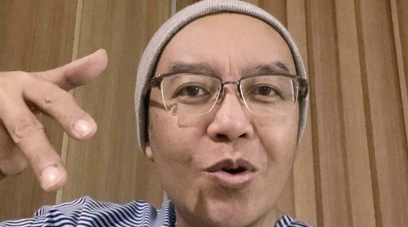 Usai Jalani 3 Kali Kemoterapi, Ari Lasso Pamer Gaya Baru: Saya Gundul Seperti Ahmad Dhani