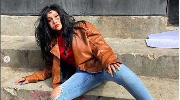 Bikin Heboh! Lucinta Luna Unggah Foto Wajah Babak Belur: Tolong Saya