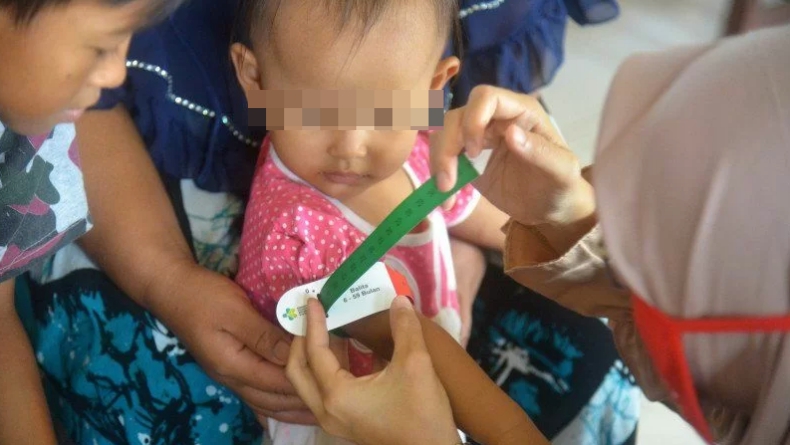 Pilu, Bocah 7 Tahun di Bogor Alami Gizi Buruk