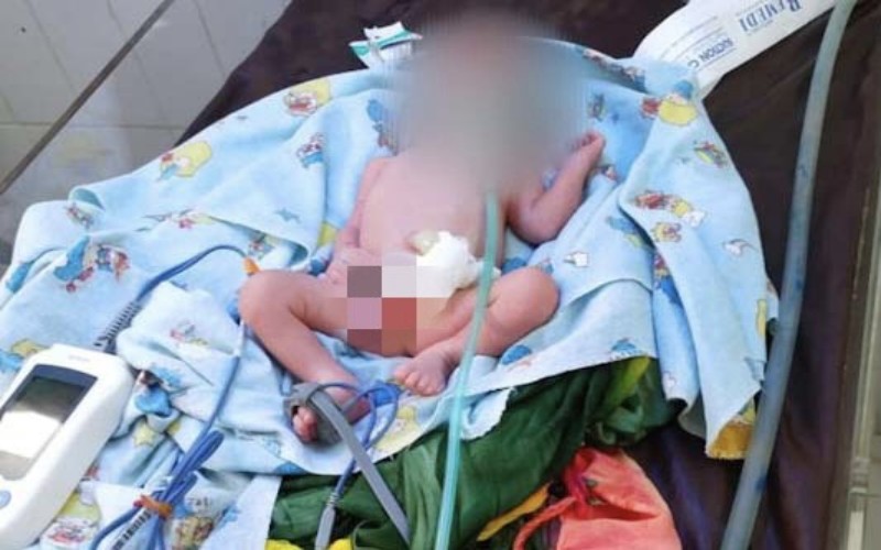 Puskesmas Jatinegara Bantah Tolak Beri Pertolongan ke Bayi yang Ditemukan di Tepi Ciliwung