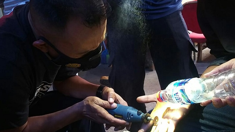 Jari Bengkak lantaran Cincin Tak Bisa Dilepas, Warga Minta Tolong Damkar Cimahi