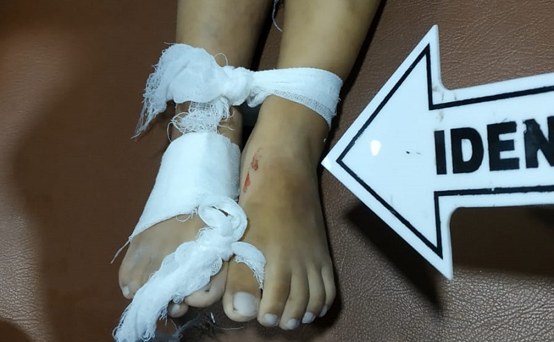 Lepas dari Pangkuan, Balita di Mojoketo Tewas Terlindas Truk