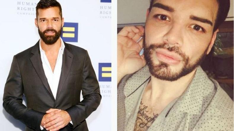 Wow, Pria Ini Jalani 30 Kali Operasi Demi Mirip Ricky Martin