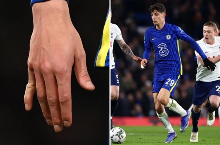 Mengerikan! Jari Tangan Kai Havertz Patah usai Robek Gawang Tottenham