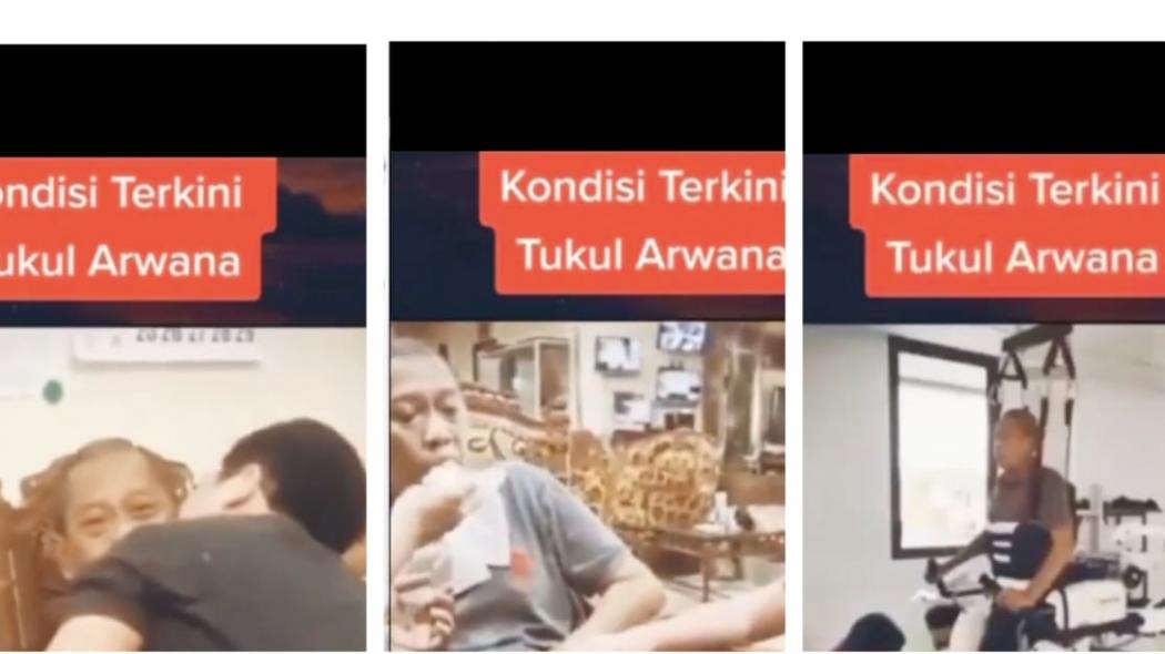 Jadi Sorotan, Begini Kondisi Tukul Arwana Selama Masa Pemulihan Pascaoperasi Pendarahan Otak