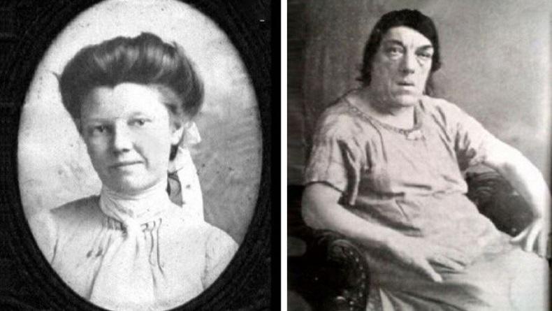 Sosok Mary Ann Bevan, Perawat yang Ikuti Kontes Wanita Terjelek di Dunia demi Keluarga