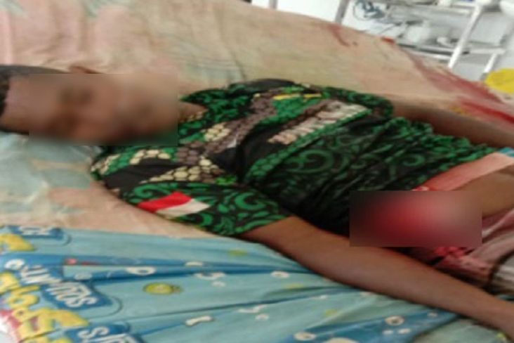  Begini Kronologi Anggota TNI Gugur Ditembaki KKB saat Perbaiki Jembatan