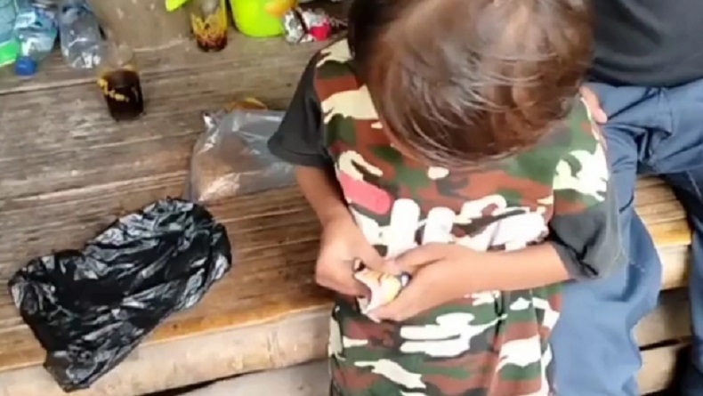 Fenomena Bocah Ngemil Papir selama 5 Tahun, Ini Kata Kepala Dinkes Cianjur