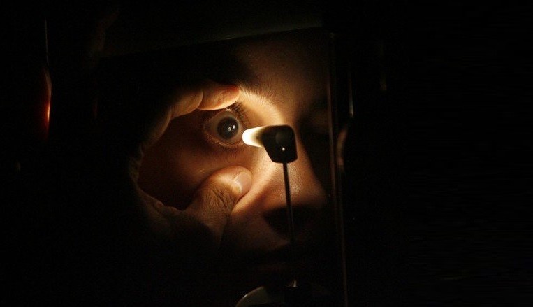 Syarat Donor Mata yang Harus Dipenuhi, Ahli Waris Pendonor Wajib Tahu