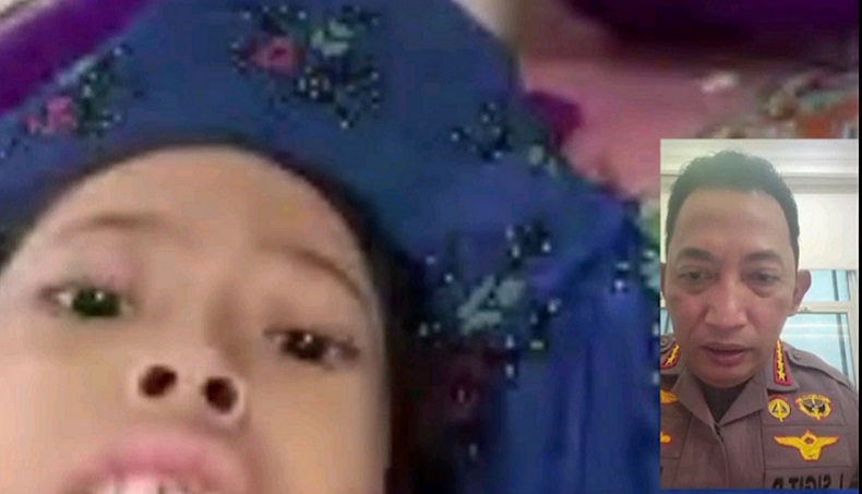 Kapolri Kirim Tim Dokter untuk Sembuhkan Anak Sinta Aulia yang Sakit Tumor Kaki