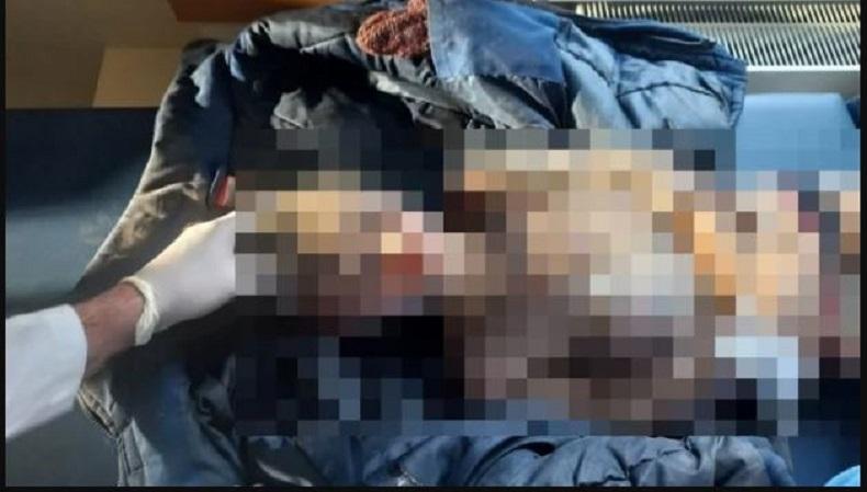 Tragis! Bocah di Ukraina Tewas Dehidrasi, 8 Hari Tanpa Makanan dan Air 