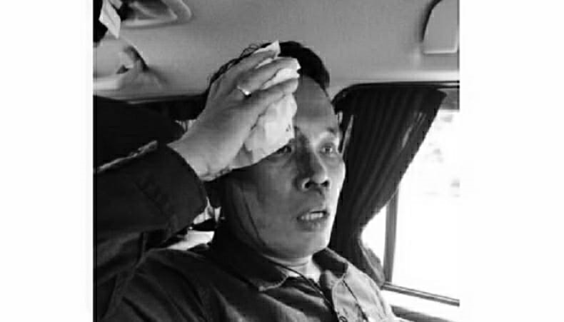 Ricuh Demo Mahasiswa Papua di Kemendagri, Kasat Intel Polres Jakpus Terluka