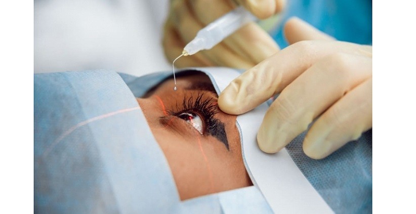 Penglihatan Buram Pascaoperasi Katarak, Apa Saja Faktor Risikonya?