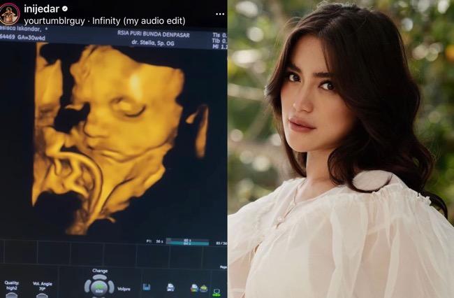 Jessica Iskandar Ungkap Wajah Anak Kedua, Netizen: Definisi Ganteng dari Orok