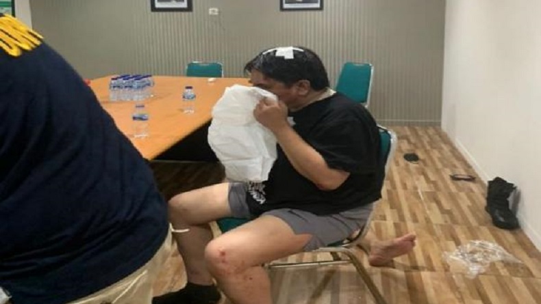 Kondisi Ade Armando Disebut Membaik dan Sudah Bisa Tertawa