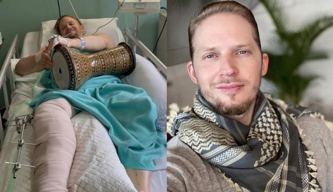 Dirawat akibat Kecelakaan Mobil, Daood Debu Butuh Biaya Rp800 Juta Lebih