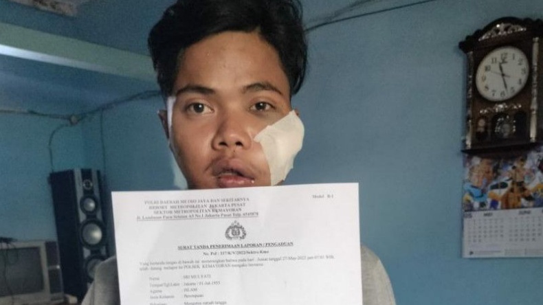 Kurir Dibacok Begal di Kemayoran, Pipi Sobek Mata Lebam