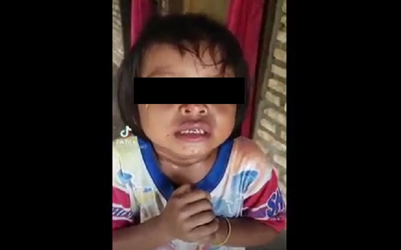 Polisi Selidiki Kasus Bocah Diduga Dianiaya sampai Bibir Bengkak di Sergai