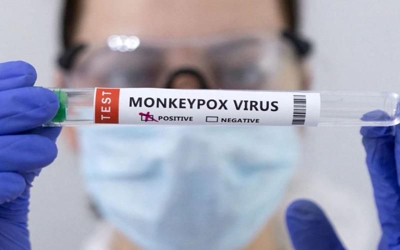 Cacar Monyet Berpotensi Sebabkan Komplikasi Paru-Paru, Ini Penjelasannya