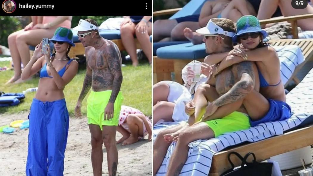 Pascapemulihan Sindrom Ramsay Hunt, Ini yang Dilakukan Justin Bieber Sekarang