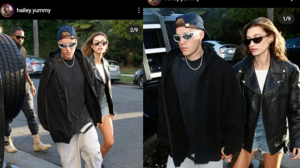 Jalani Pengobatan Sindrom Ramsay Hunt, Begini Wajah Justin Bieber Sekarang