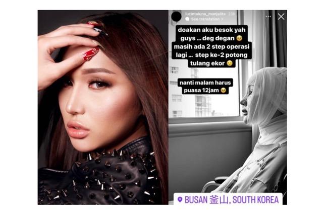 Bakal Jalani Operasi Tulang Ekor Usai Pemotongan Jakun, Lucinta Luna Minta Doa 