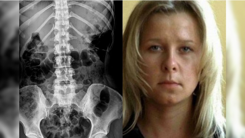 Natasha Demkina, Wanita dengan Mata Berkemampuan X-Ray Asal Rusia