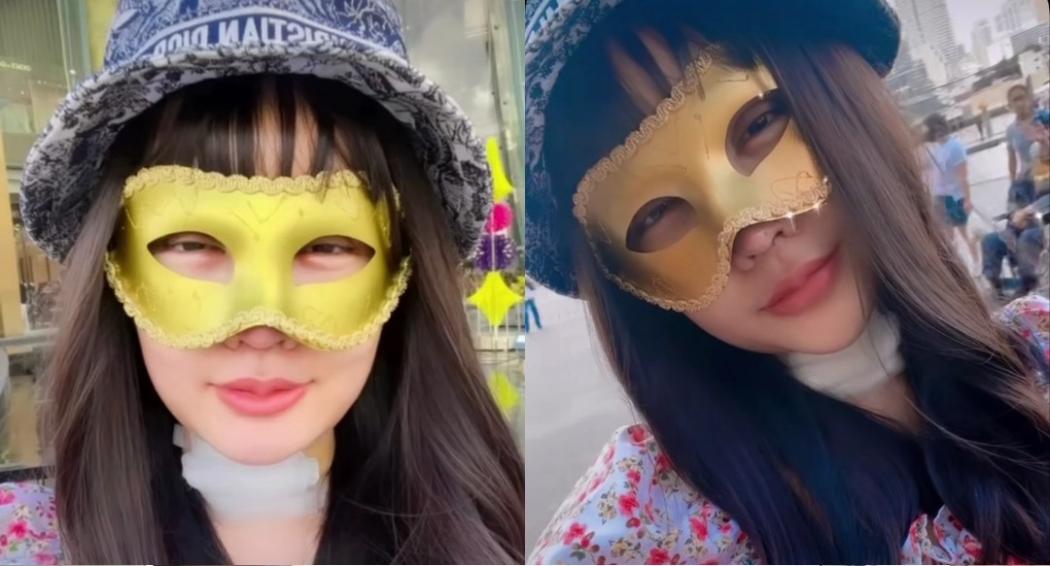 Lucinta Luna Operasi Jakun dan Rahim, Netizen Penasaran Hasilnya: Ayo Unboxing