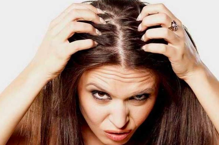 3 Cara Menghilangkan Kotembe, Bisa Pakai Lemon hingga Madu