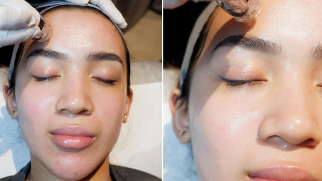 Intip Cara Perawatan Kulit Wajah agar Tampak Glowing , Modalnya hanya Serum