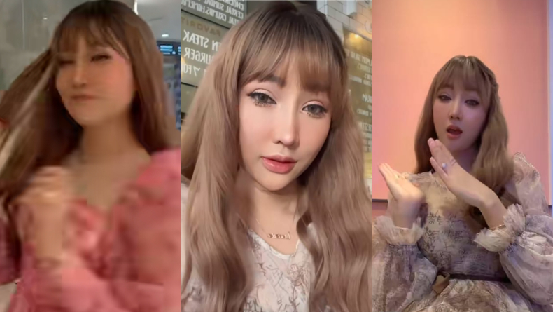 7 Artis yang Pernah Suntik Filler Bibir, dari Siti Badriah Hingga Nikita Mirzani