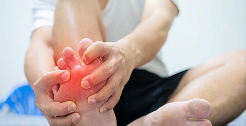 Kenali Penyebab Muncul Mata Ikan di Kaki