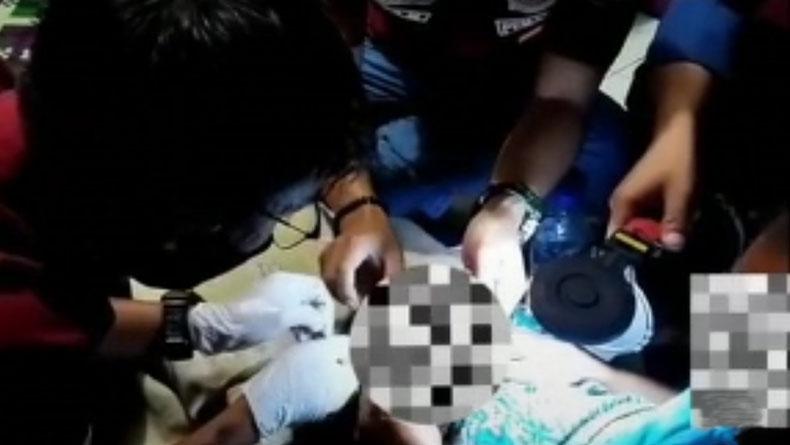 Pria Paruh Baya Warga Baros Sukabumi Nekat Pasang Cincin di Kemaluan, Ini Akibatnya