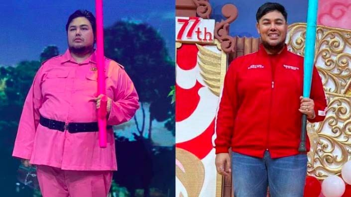 5 Artis yang Pernah Melakukan Sedot Lemak, Ada yang Dua Kali dalam Seminggu