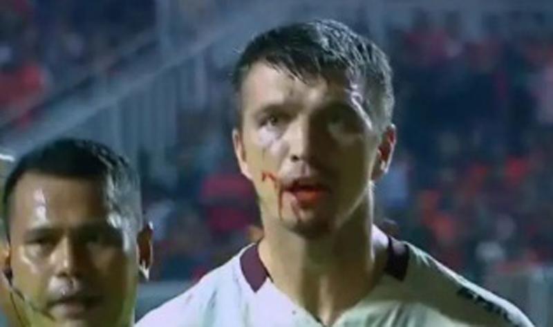 Persija Bantai RANS Nusantara, Satu Pemain Macan Kemayoran Dilarikan ke RS