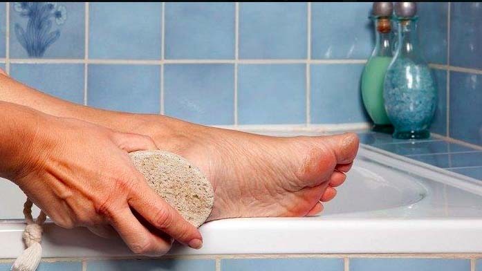 Ini 5 Cara Mengobati Kaki Pecah-Pecah agar Tidak Makin Parah