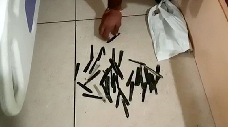 Dokter Terkejut Ada 63 Sendok di Dalam Perut Pria Ini, Awalnya Dikira Tumor